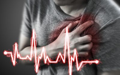 Srčani infarkt – uzrok, simptomi, liječenje