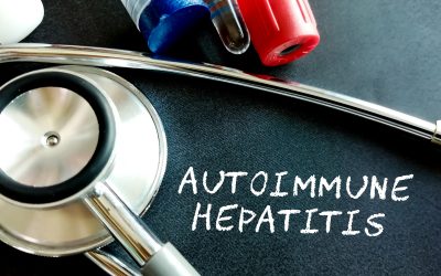 Autoimuni hepatitis – uzrok, simptomi, liječenje
