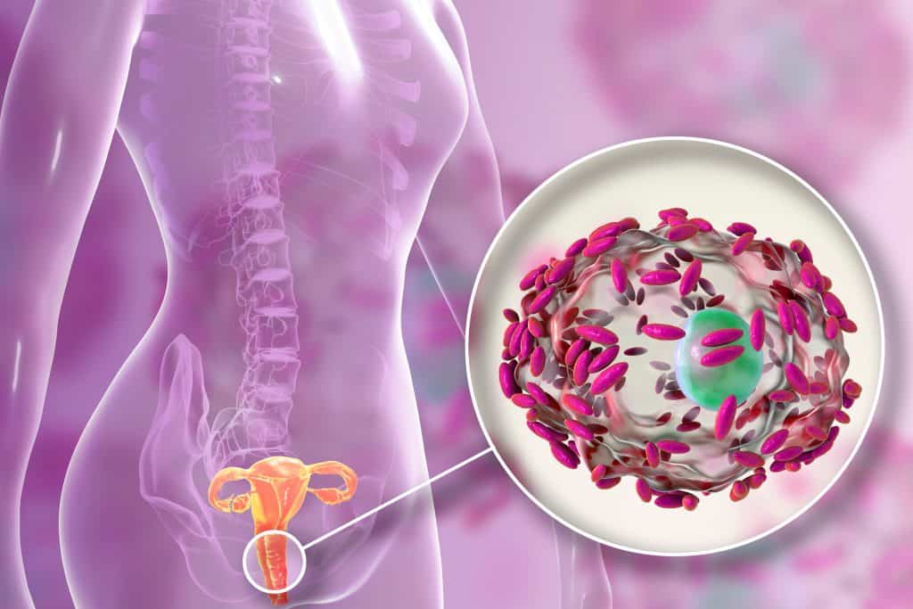 Bakterijska vaginoza - uzrok, simptomi, liječenje