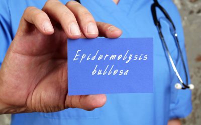 Bulozna epidermoliza – uzrok, simptomi, liječenje