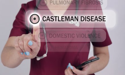 Castlemanova bolest – uzrok, simptomi, liječenje