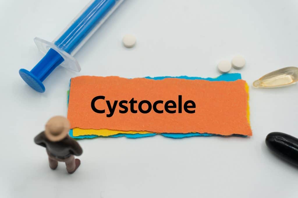 Cistocela - uzrok, simptomi, liječenje