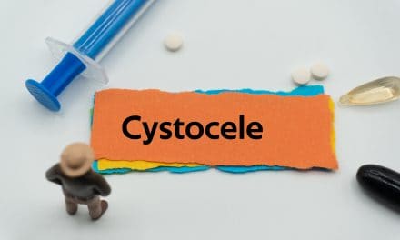 Cistocela – uzrok, simptomi, liječenje
