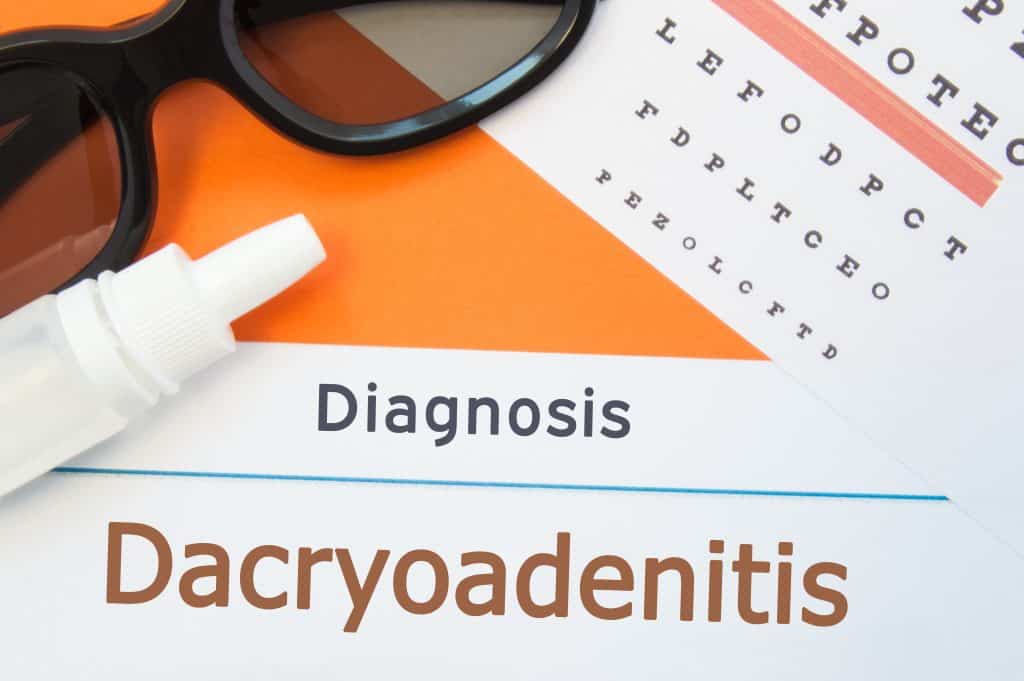 Dakrioadenitis - uzrok, simptomi, liječenje