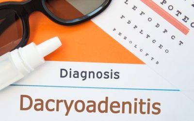 Dakrioadenitis – uzrok, simptomi, liječenje