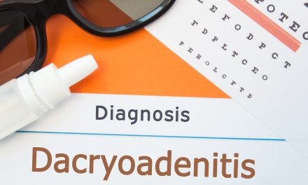Dakrioadenitis – uzrok, simptomi, liječenje