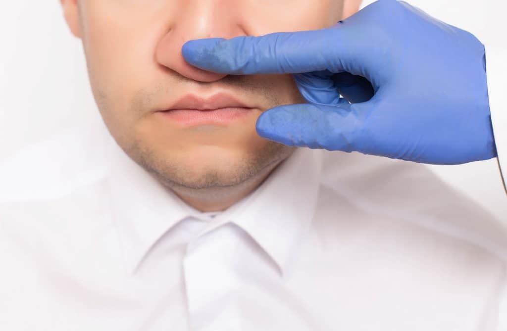 Deformacija nosne pregrade - uzrok, simptomi, liječenje