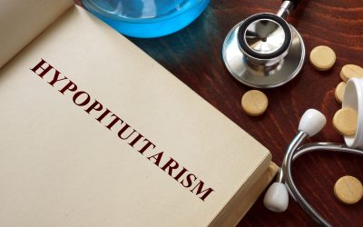 Hipopituitarizam – uzrok, simptomi, liječenje