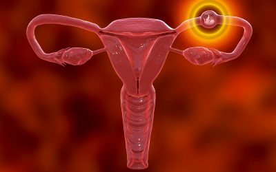 Izvanmaternična trudnoća – što je i kako do nje dolazi