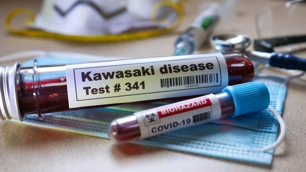 Kawasakijeva bolest - uzrok, simptomi, liječenje