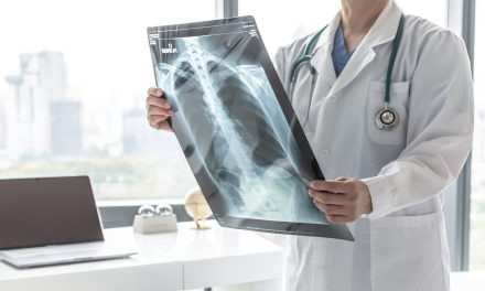 Kronična opstrukcijska plućna bolest – uzrok, simptomi, liječenje
