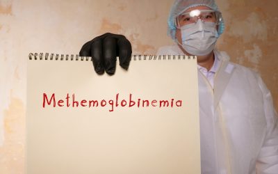 Methemoglobinemija – uzrok, simptomi, liječenje