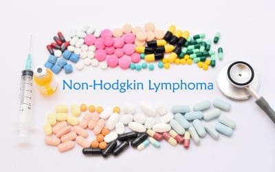 Ne-Hodgkinovi limfomi – uzrok, simptomi, liječenje