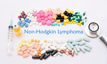 Ne-Hodgkinovi limfomi – uzrok, simptomi, liječenje