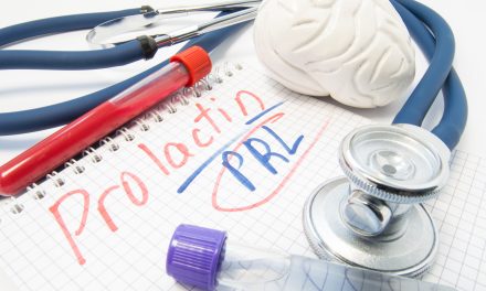 Prolaktinom – uzrok, simptomi, liječenje