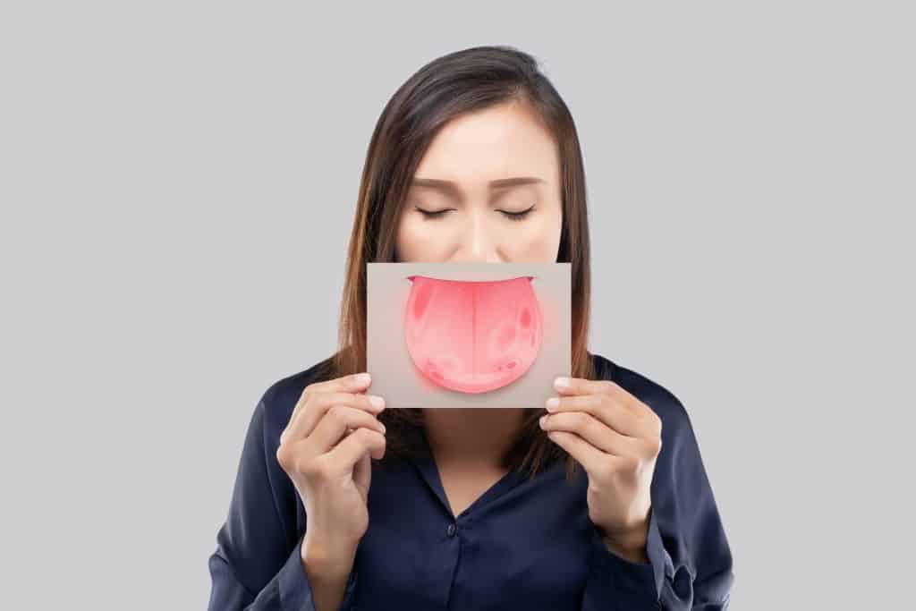 Sindrom gorućih usta - uzrok, simptomi, liječenje