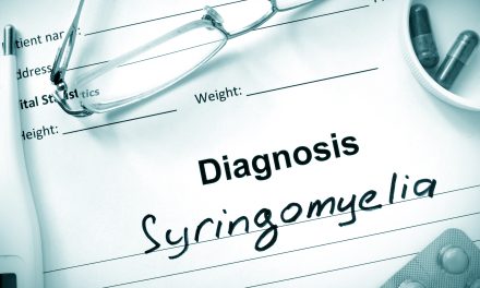 Siringomijelija – uzrok, simptomi, liječenje