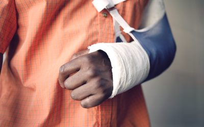 Slomljena ruka – uzrok, simptomi, liječenje