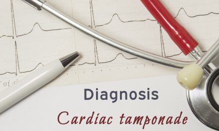 Srčana tamponada – uzrok, simptomi, liječenje