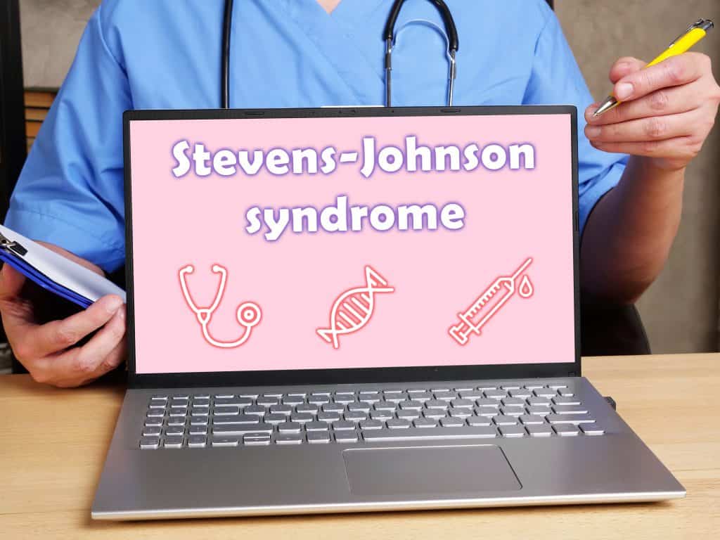 Stevens Johnsonov sindrom - uzrok, simptomi, liječenje