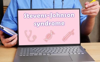 Stevens Johnsonov sindrom – uzrok, simptomi, liječenje