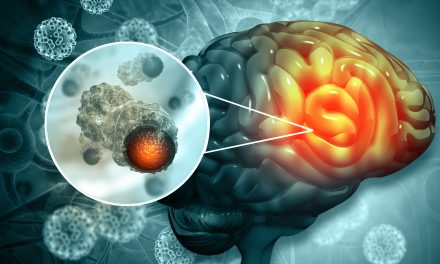 Tumori mozga – uzrok, simptomi, liječenje