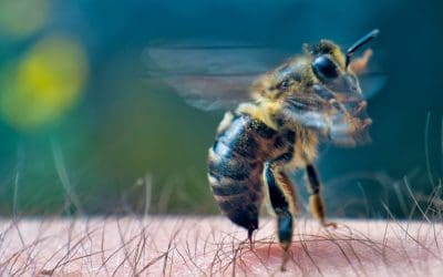 Ubodi pčele – simptomi i liječenje