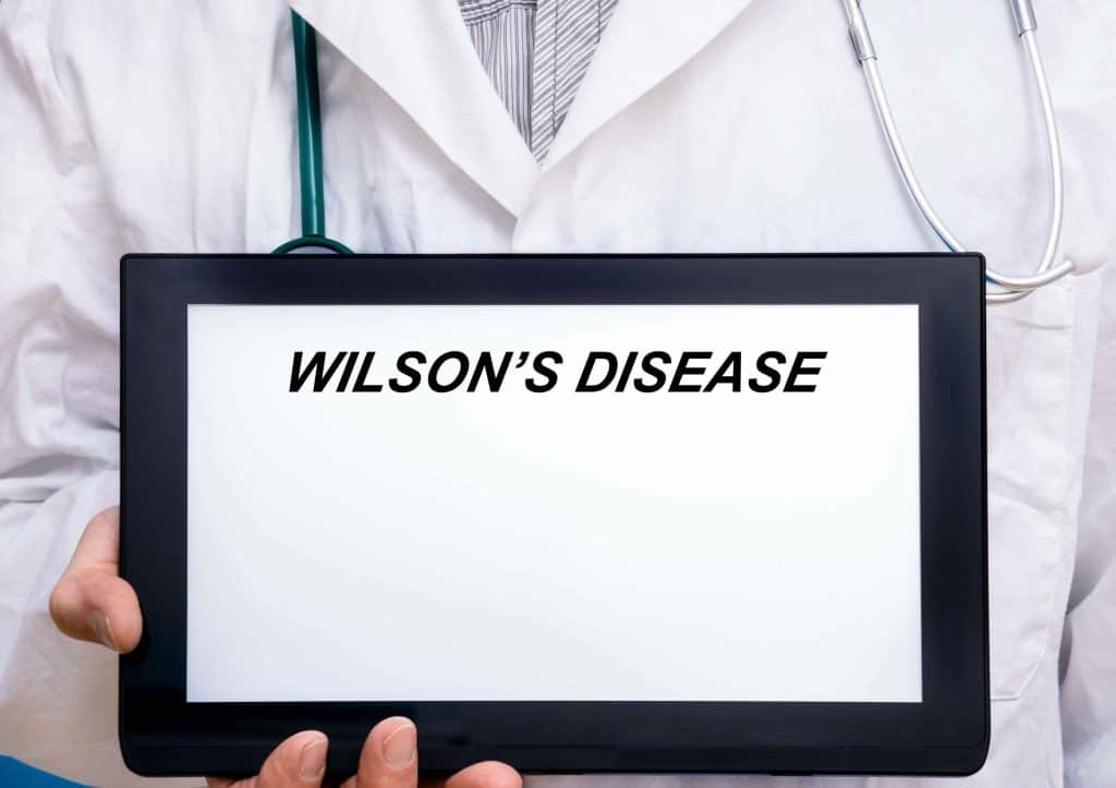 Wilsonova bolest - uzrok, simptomi, liječenje