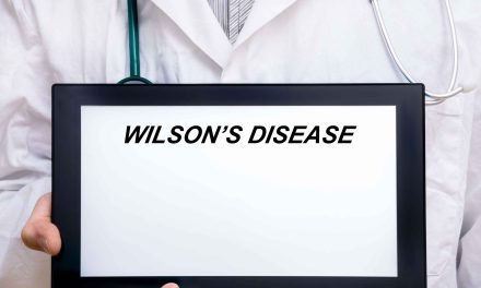 Wilsonova bolest – uzrok, simptomi, liječenje