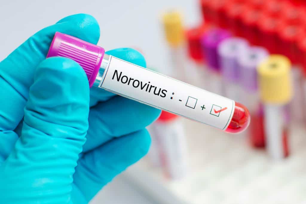 Zaraza Norwalk virusom - uzrok, simptomi, liječenje