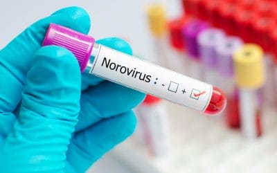 Zaraza Norwalk virusom – uzrok, simptomi, liječenje
