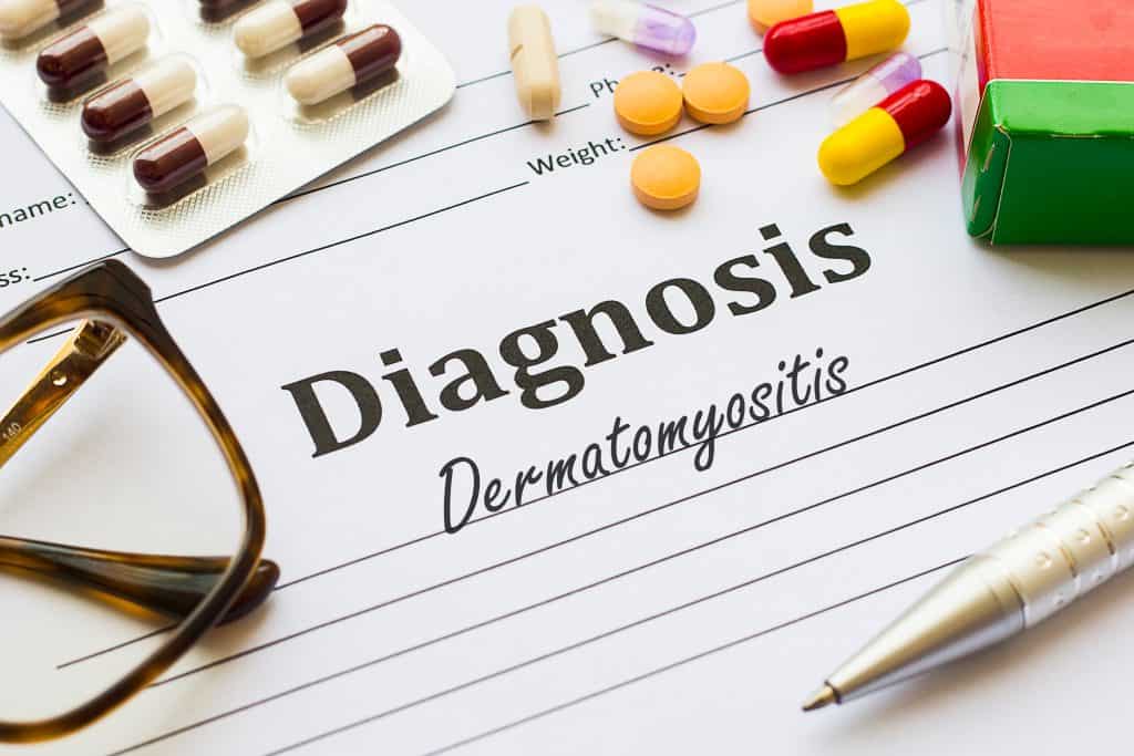Dermatomiozitis - uzrok, simptomi, liječenje