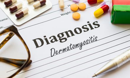 Dermatomiozitis – uzrok, simptomi, liječenje