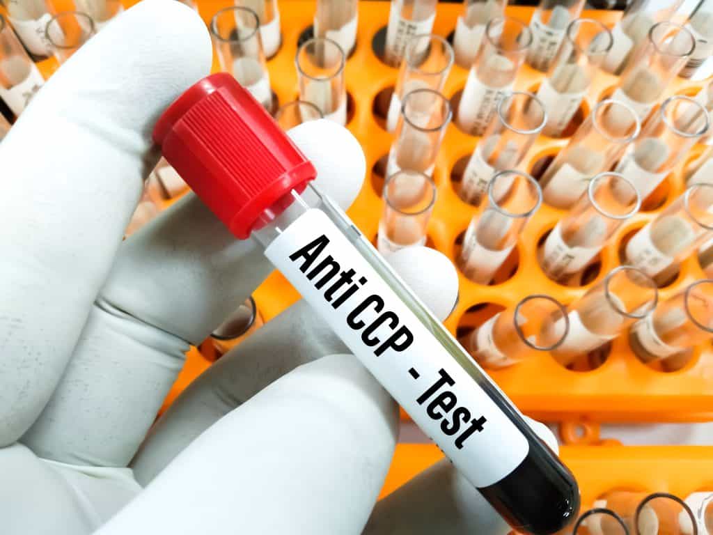 Što je ciklički citrulinirani protein (ccp)