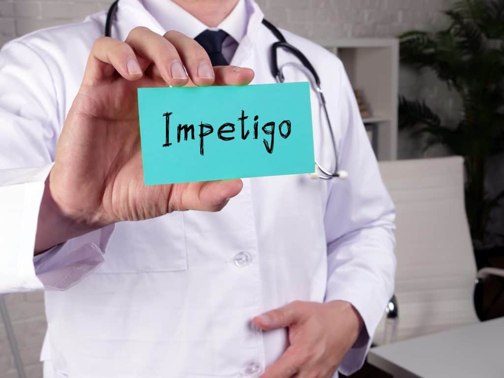 Impetigo - uzrok, simptomi, liječenje
