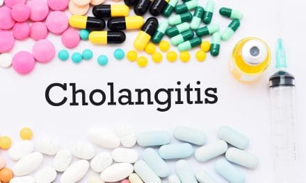 Što je kolangitis – uzrok, simptomi, liječenje