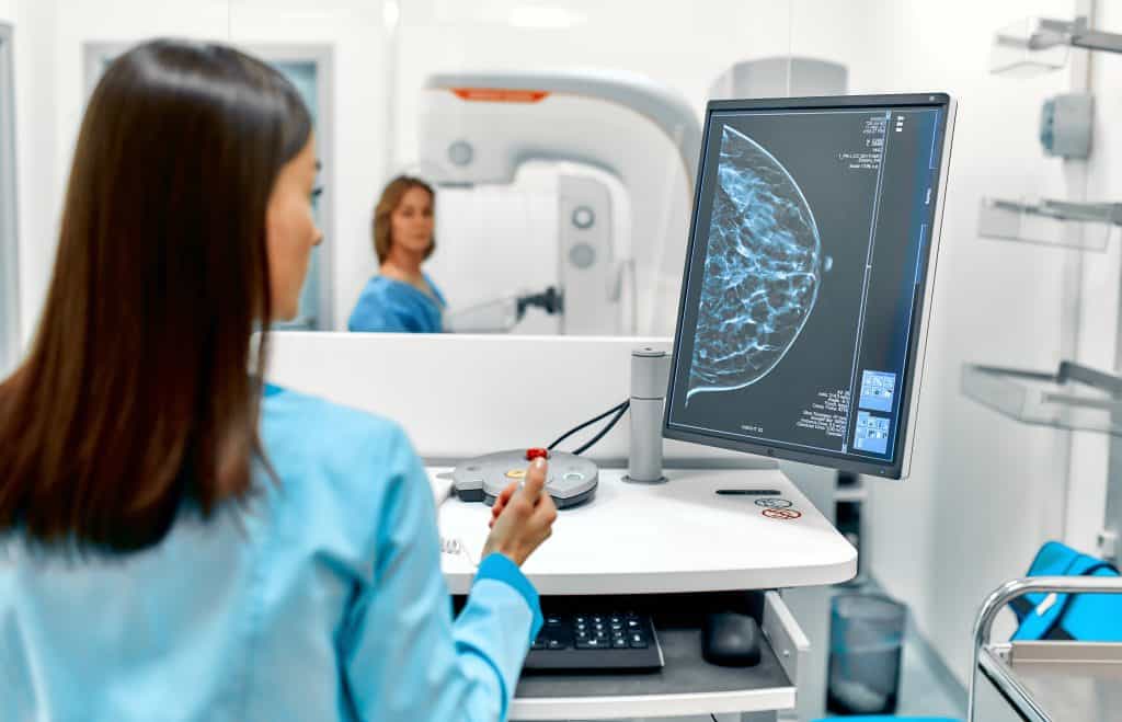 Što je mamografija