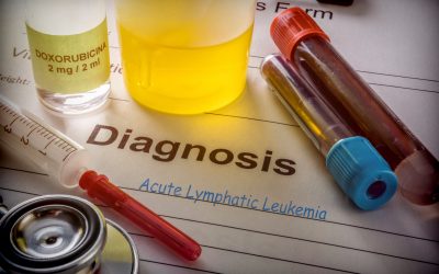 Što je akutna limfatična leukemija – uzrok, simptomi, liječenje