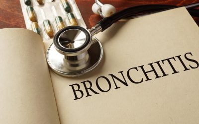 Što je akutni bronhitis – uzrok, simptomi, liječenje