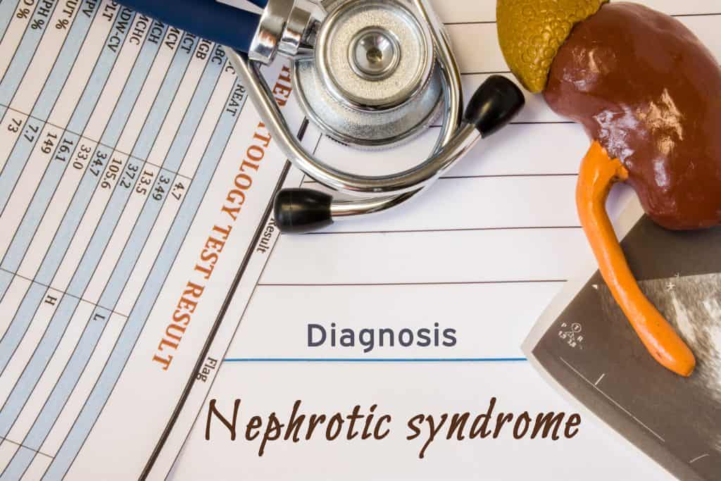 Što je nefrotski sindrom - uzrok, simptomi, liječenje