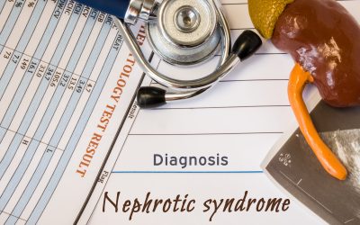 Što je nefrotski sindrom – uzrok, simptomi, liječenje
