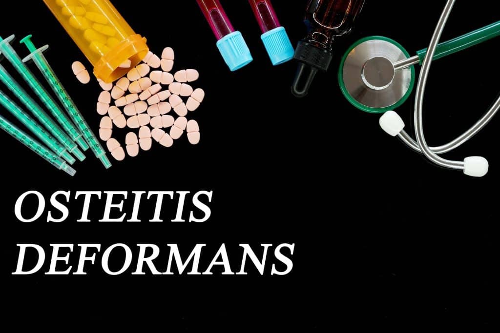 Što je osteitis