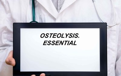 Što je osteoliza
