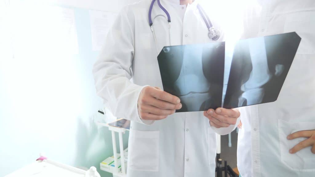 Što je pseudoartroza Što je pseudoartroza