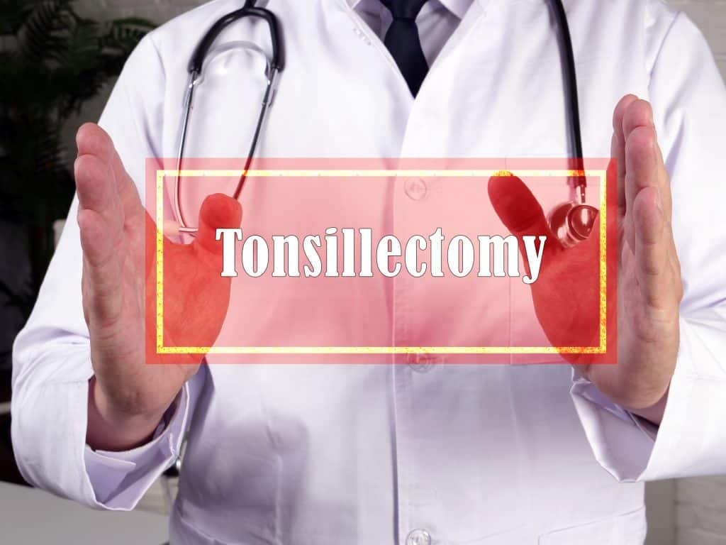 Što je tonzilektomija