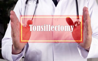 Što je tonzilektomija