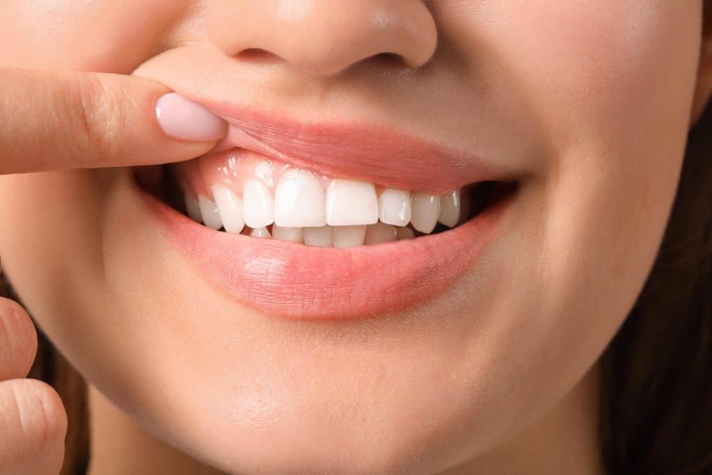 Što je zubna caklina