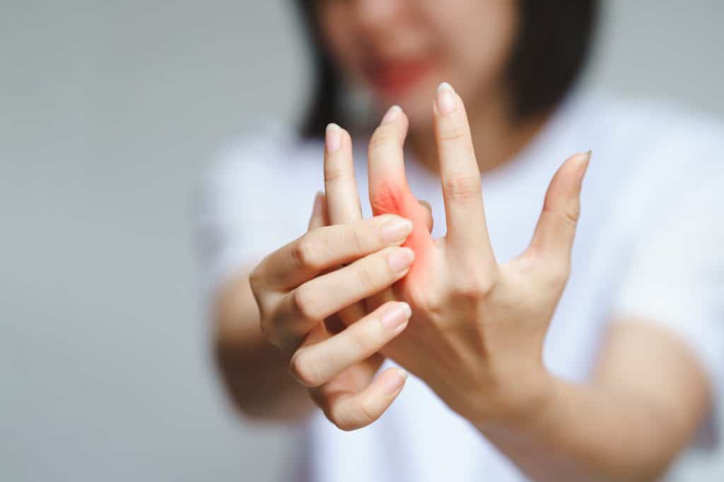 Kako ublažiti artritis