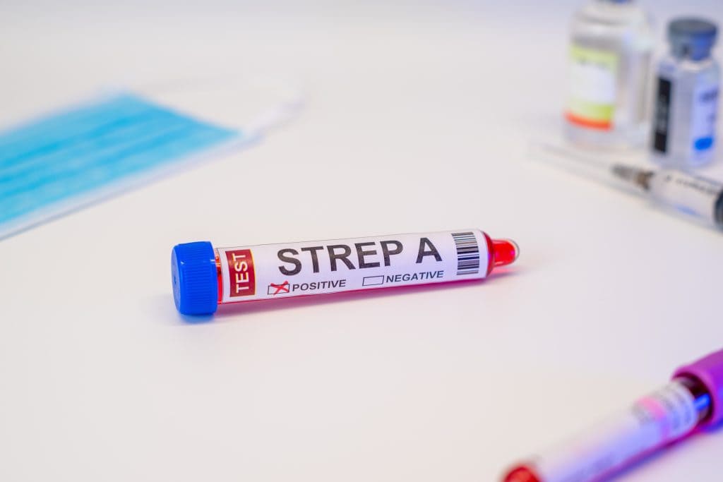 Brzi test na streptokok gdje kupiti