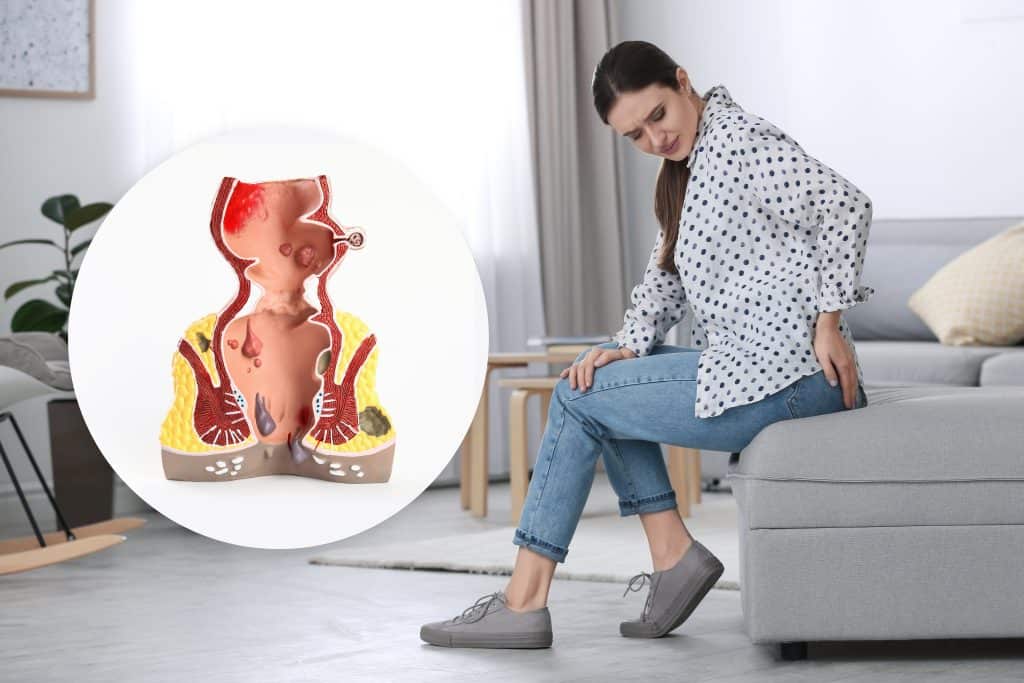 Kamagra Hemoroclear - što je i kako djeluje